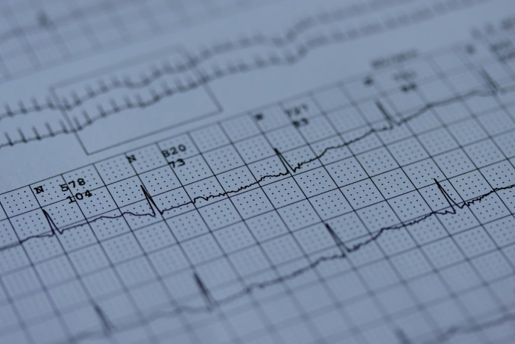 Trace de donnees medicales sur papier millimetre