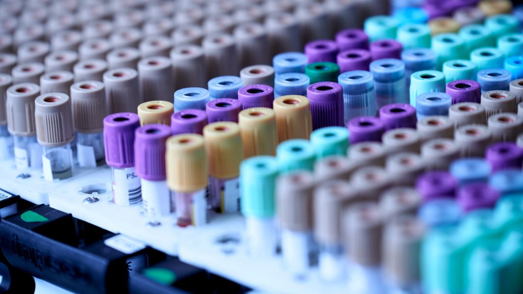Tubes de prelevement sanguin en laboratoire pour un bilan lipidique de controle